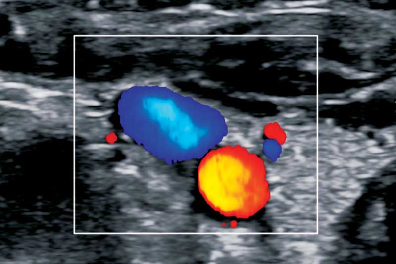 By placing a probe on the pet’s chest, clients can see the heart pumping and visualize the veterinarian’s diagnosis.