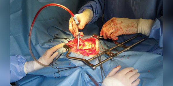 A baker’s dozen hacks for surgery lovers