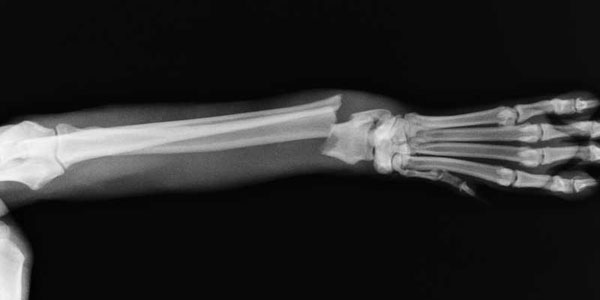 Six key strategies to revamp your pain management protocols
