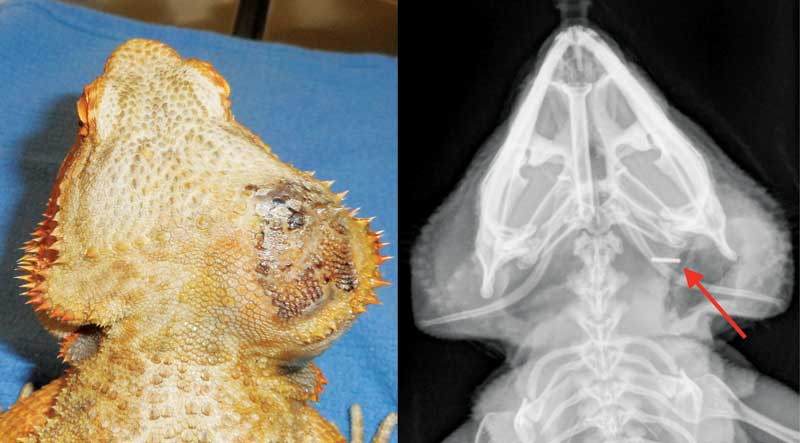 Figure 5: A severe cephalic aneurysm. A contrast CT was performed to identify the location of the leaking vessel. A vascular clip was surgically applied. The patient recovered uneventfully and lived for an additional five years.