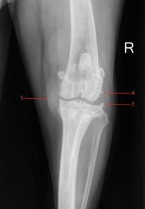 The medial buttress is visible on this VD radiograph of the stifle.