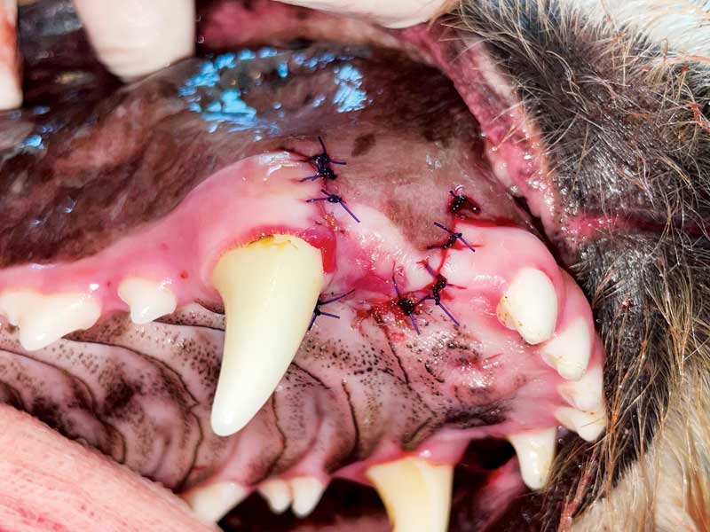 Figure 4: A mucogingival flap is raised to close the extraction site of tooth 103 and to repair the palatal defect.