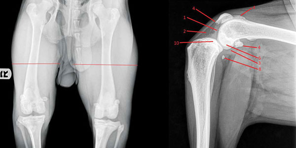 How to diagnose ACL tears on X-rays