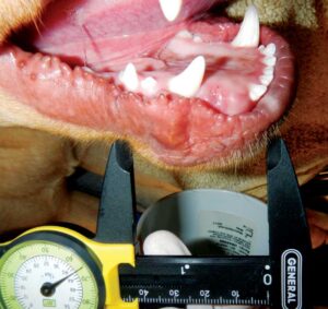 Figure 2: Distal displacement and linguoversion of tooth 404. Tooth 403 appears to be missing.