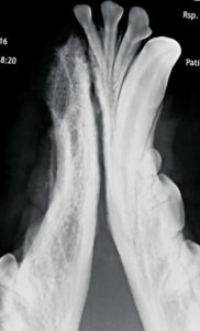 Figure 5: Intraoral radiograph of rostral mandible, approximately one year after surgery. Note the consolidation of the cystic bone structure in the area of missing 403, 404.
