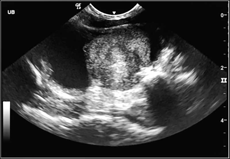 Figure 3: Transitional cell carcinoma in the urinary bladder of a cat. Photo courtesy Nicole Martell-Moran