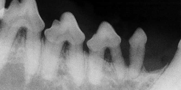 Let’s stop using the term ‘dental disease’