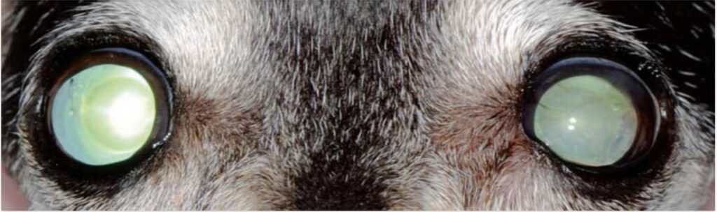 A clear look at cataract conditions and treatments