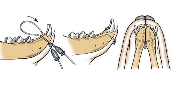 Treating mandibular symphyseal separation