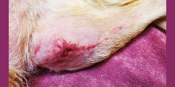 Exploring surgical site infections