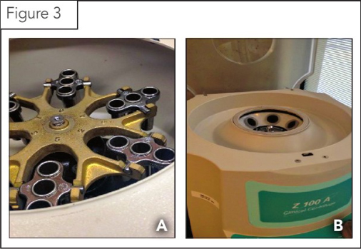 Types of centrifuges used in veterinary parasitology. Modified double centrifugal flotation can be carried out using either swinging-bucket (Figure 3A) or fixed-bucket (Figure 3B) models. With the latter, the tube would be topped off with media following the second spin, a coverslip would be placed, and the sample would need to sit an additional 10 minutes. After that, the coverslip would be placed on a microscope slide and examined on 100x magnification.