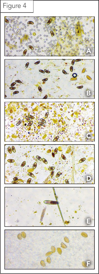 Representative pinworm eggs from: A, B) an inland bearded dragon (Pogona vitticeps); C) a northern blue-tongued skink (Tiliqua scincoides intermedia); D) a shingleback skink (Tiliqua rugosa); and E) a black roughneck monitor (Varanus rudicollis). Also, F) representative trematode eggs (F). The image from the inland bearded dragon (A) also shows numerous coccidian oocysts belonging to the genus Eimeria.