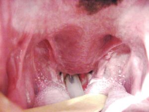 Elongated soft palate extending into the laryngeal opening.Photos courtesy Ray Arza