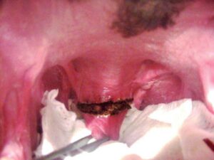 Initial partial thickness incision in soft palate.