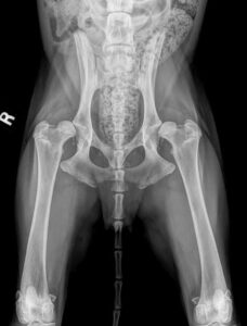 Early detection key in hip dysplasia cases
