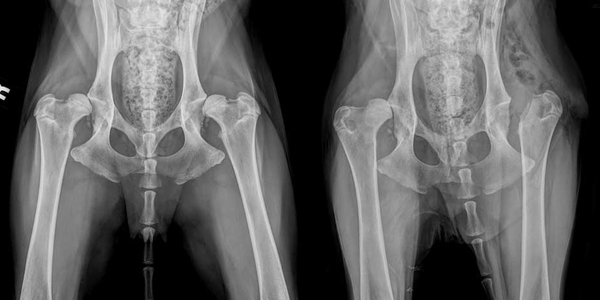 Early detection key in hip dysplasia cases