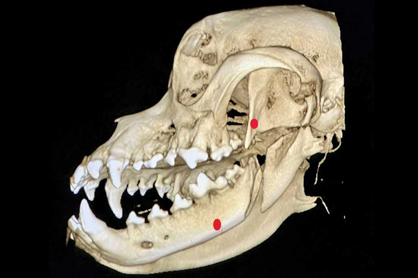 A ‘mini’ new technology for jaw fractures