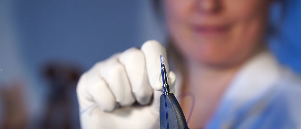 Innovative BoneWelding® technology offers advantages over metal plating systems for maxillofacial fractures
