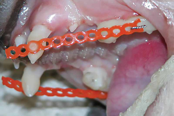 Active orthodontics: Moving problematic teeth
