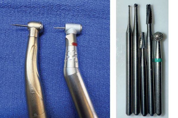 Keep on drilling! A handy guide to dental burs and handpieces