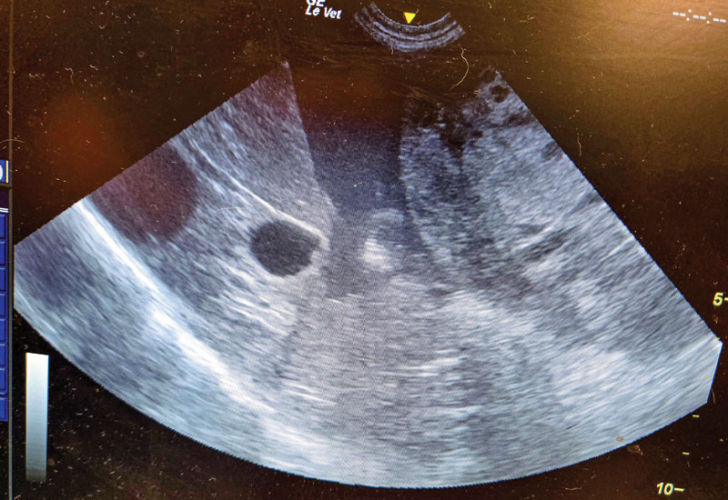 Part 1: Using ultrasound in the ER setting