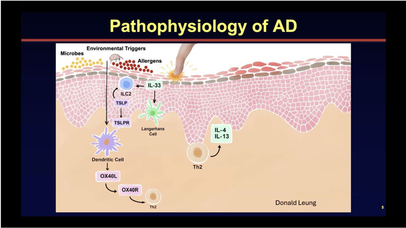 Effective Topical Therapy for Your Atopic Dermatitis Patients: Why it Matters