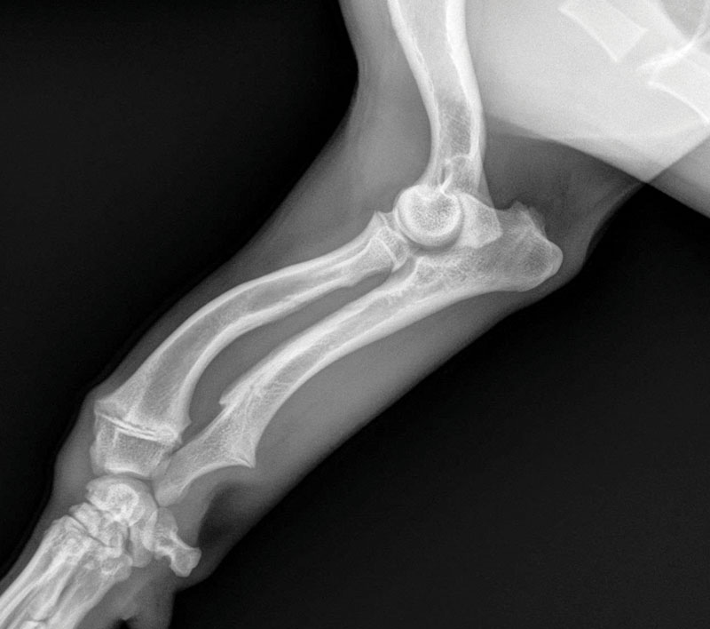 Beyond surgery: A multimodal approach to managing osteoarthritis (OA) pain