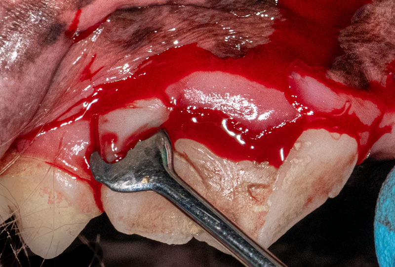 Separate the attached gingiva from the alveolar ridge