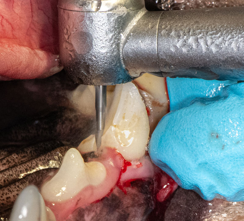 Sectioning the palatal root