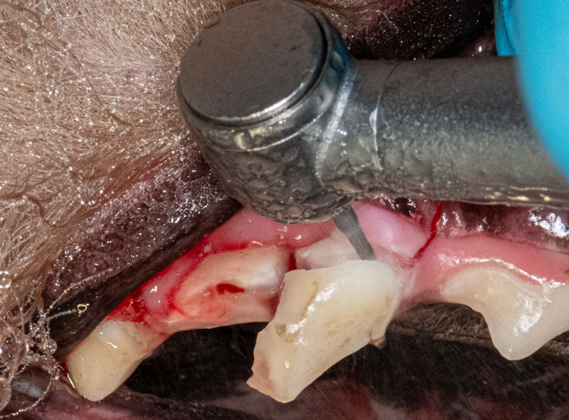 Horizontal positioning of the bur for coronectomy