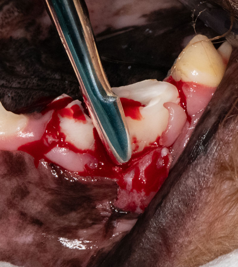 Inserting wing-tipped elevator between the sectioned roots