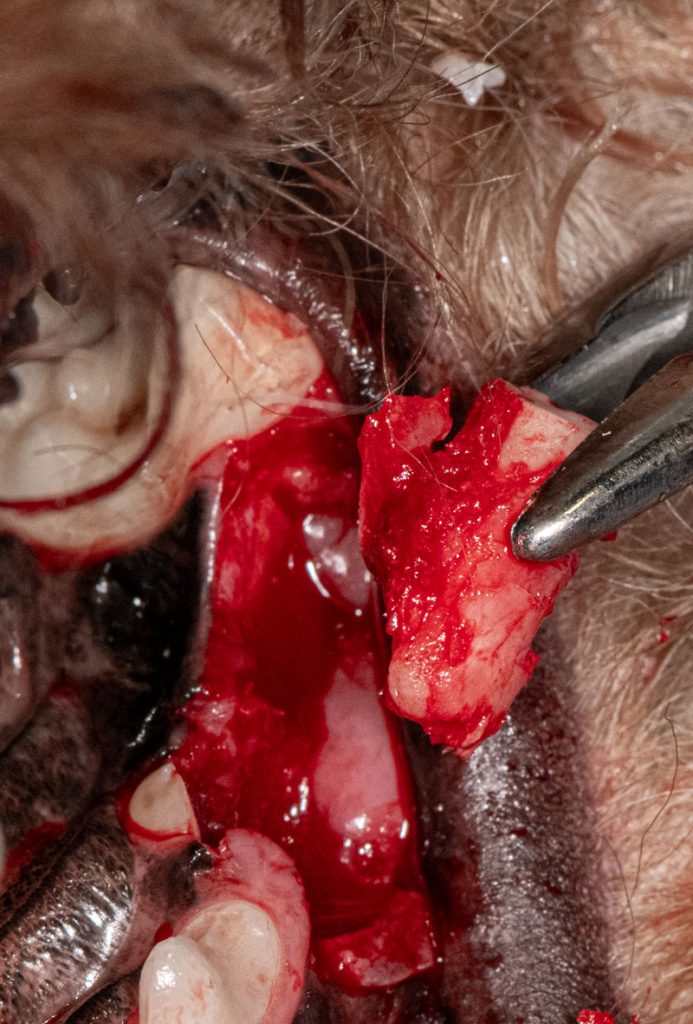 Delivery of distal root