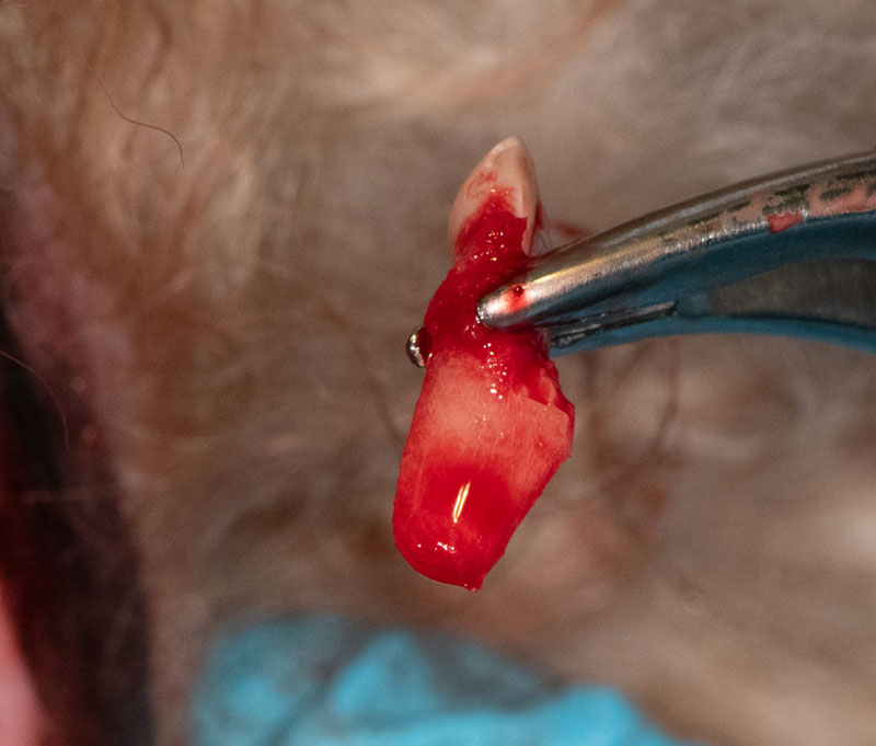  Delivery of palatal root.