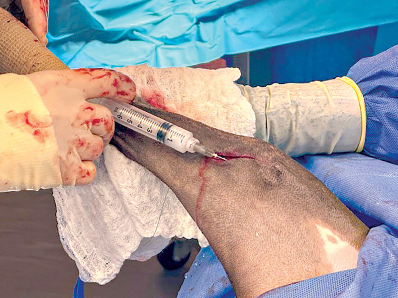Developing a balanced perioperative analgesia plan