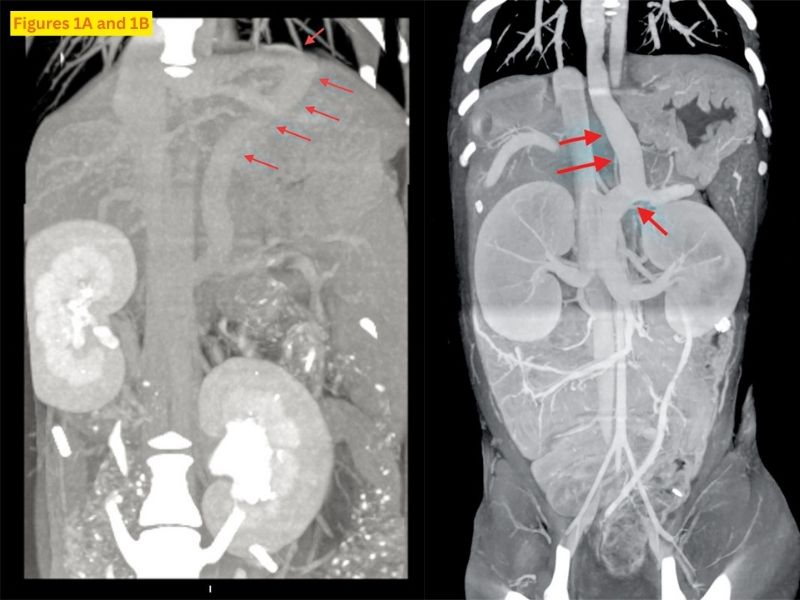 Diagnosing vascular anomalies in puppies