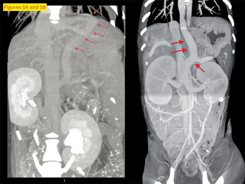 Diagnosing vascular anomalies in puppies