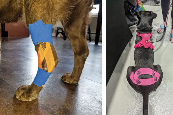 Kinesiology taping–does it work? If so, how?