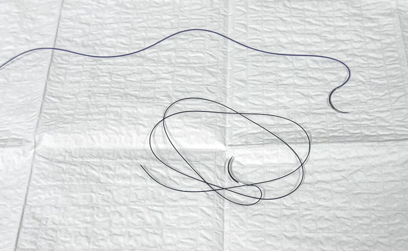 The must-read guide to selecting sutures