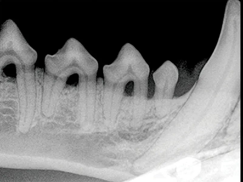 Reviewing best treatment options for periodontal disease