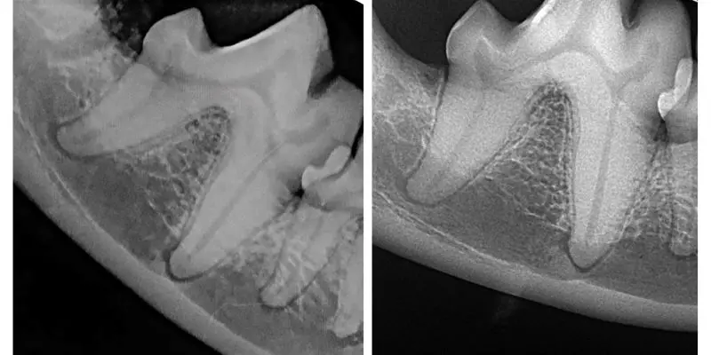 Products to treat periodontal pockets, part 2