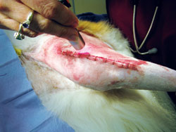 acl speedier anesthetized administered